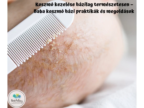 Koszmó kezelése házilag természetesen – Baba koszmó házi praktikák és olajos megoldások