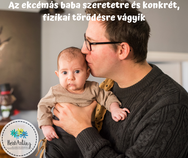 Az ekcémás baba szeretetre és konkrét, fizikai törődésre vágyik