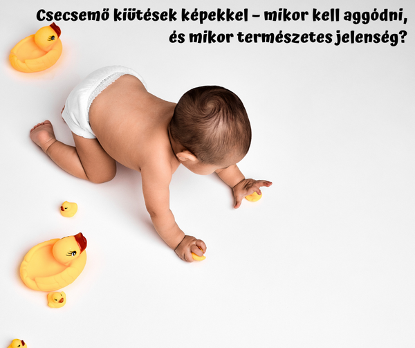 Csecsemő kiütések képekkel – mikor kell aggódni, és mikor természetes jelenség?