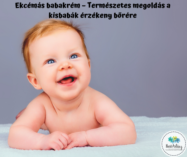 Ekcémás babakrém természetes megoldás a kisbabák érzékeny bőrére