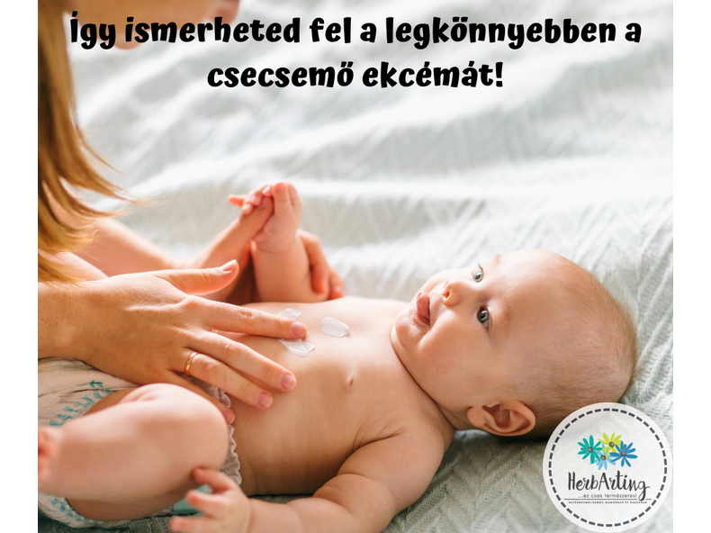 Így ismerheted fel a legkönnyebben a csecsemő ekcémát!