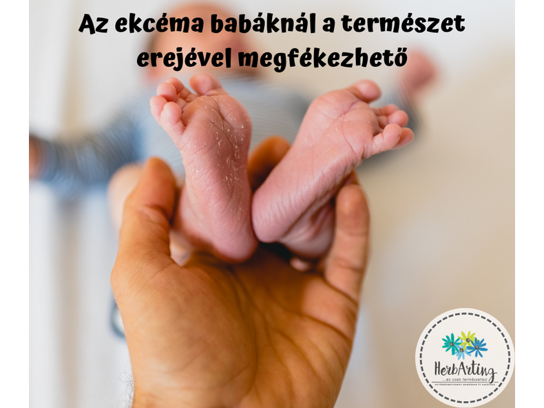 Az ekcéma babáknál a természet erejével megfékezhető