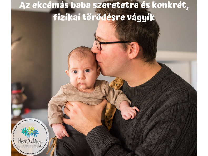 Az ekcémás baba szeretetre és konkrét, fizikai törődésre vágyik