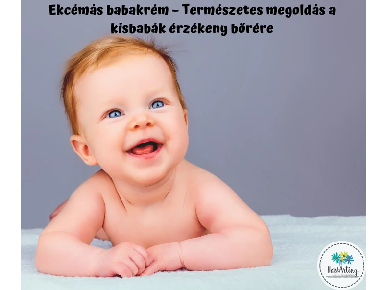 Ekcémás babakrém – Természetes megoldás a kisbabák érzékeny bőrére